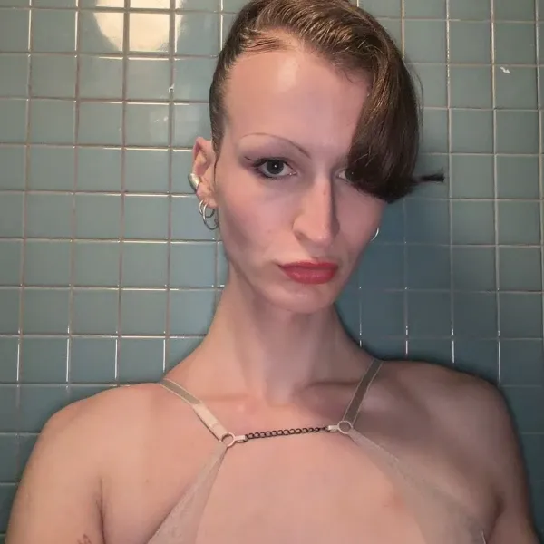Default main photo
