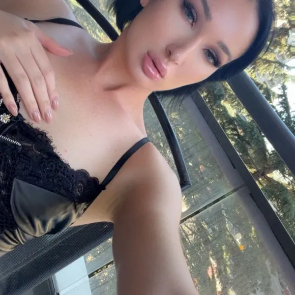 Default main photo